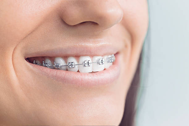 Best Wisdom Tooth Removal  in Bloomville, OH